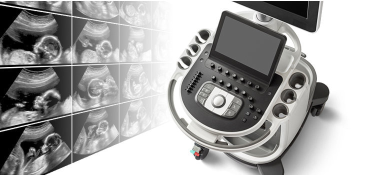 В Major Clinic появились новые ультразвуковые сканеры Philips Affiniti 70, фото 1 | Полезные материалы
