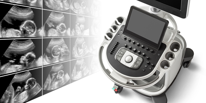 В Major Clinic появились новые ультразвуковые сканеры Philips Affiniti 70